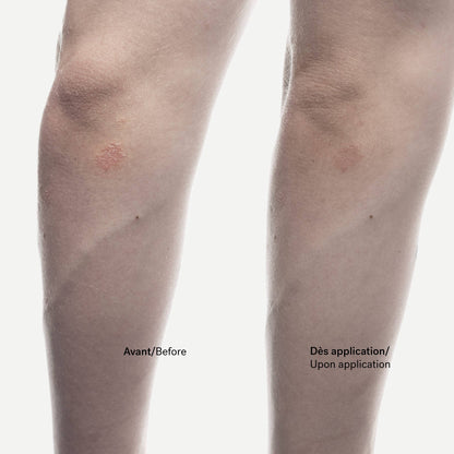 Crème Anti-Squames C92
Phytostérols 1% + Allantoïne